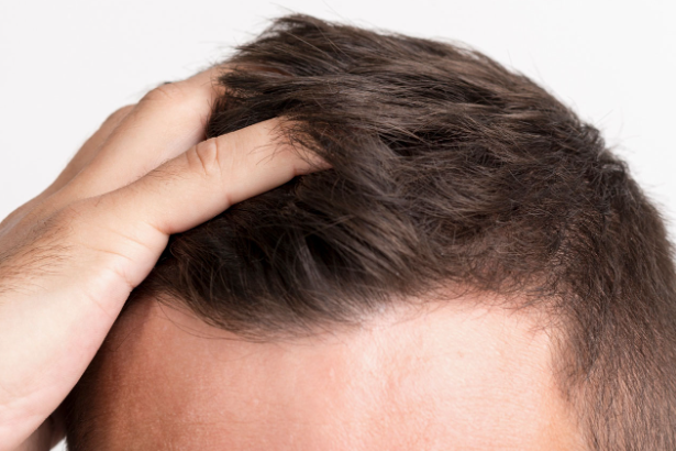 l-carnitine hair loss LeanShots Liquid L-Carnitine Shot (3000mg) main image 0